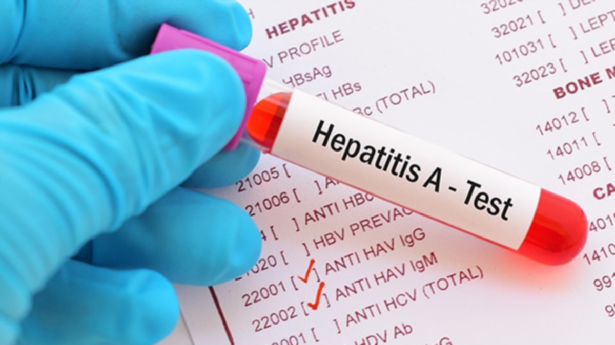 Mortality because of viral hepatitis, on the rise: what are the signs and their remedy