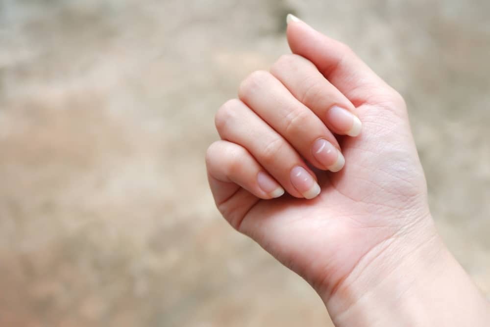 What does it mean to have ridged nails and how do you cure them?